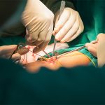 Quels sont les différents traitements possibles?