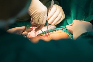 Read more about the article Quels sont les différents traitements possibles?