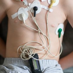 Child sitting on the sofa. Heart cardiogram or monitoring of cardiac performance using Holter.